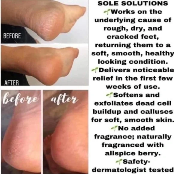 - (2) TWO Epoch NuSkin Sole Solution foot treatment